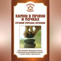 . Камни в почках и печени