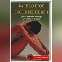 . Варикозное расширение вен. Травы, которые помогут избежать операции