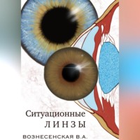 . Ситуационные линзы
