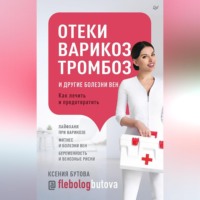 . Отеки, варикоз, тромбоз и другие болезни вен. Как лечить и предотвратить