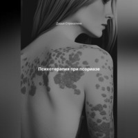 . Психотерапия при псориазе
