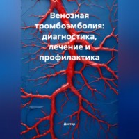 Доктор. Венозная тромбоэмболия: диагностика, лечение и профилактика