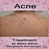 . Acne Treatment