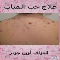 Jones Owen. علاج حب الشباب