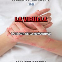 Machain Santiago. La Viruela