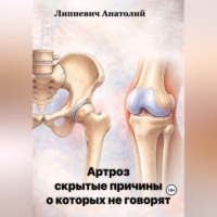 Анатолий Липневич. Артроз: скрытые причины, о которых не говорят