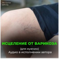 . Исцеление от варикоза. Здоровые ноги. Исцеление от отека ног (для мужчин)
